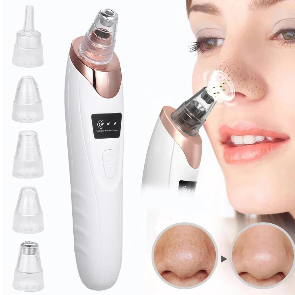 Professional 5-in-1 Blackhead Remover – Derma Suction Pore Cleansing Beauty Tool